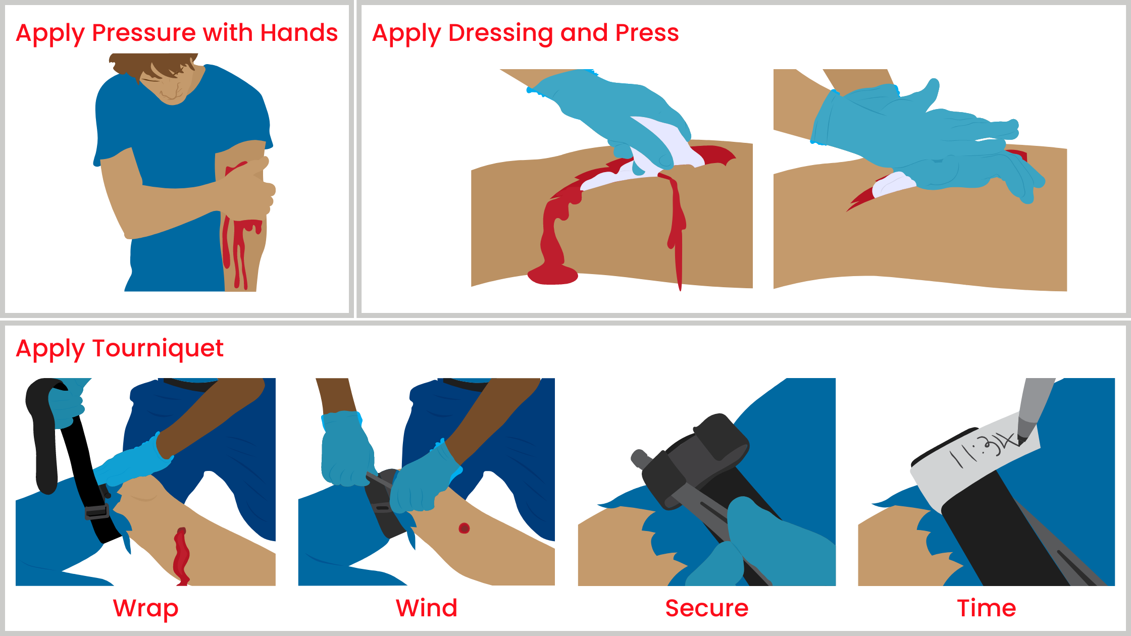 step by step illustrated directions for using a BleedStop kit:
Apply pressure with hands
Apply dressing and Press
Apply tourniquet by wrapping, winding, securing, and writing the application time